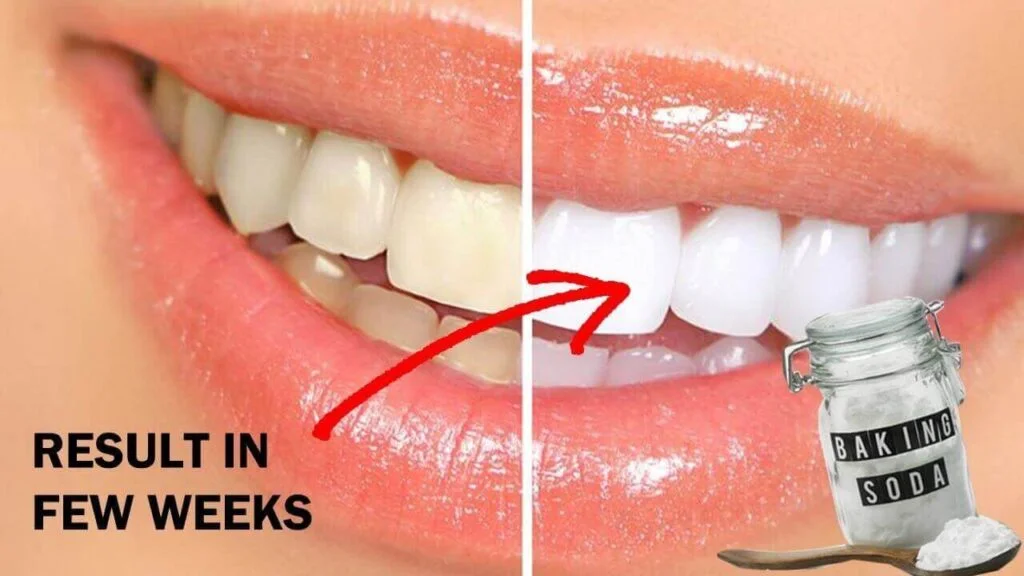 Baking Soda For Whitening Teeth