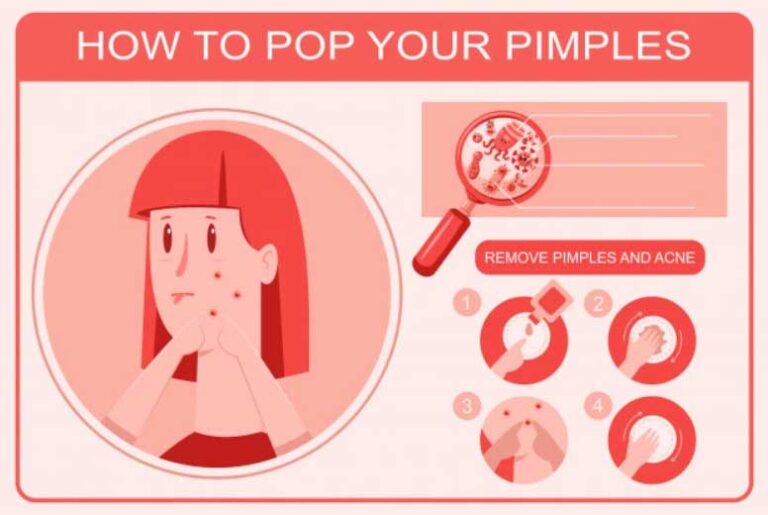 How To Pop A Pimple In A Simple Way All Beauty Hacks