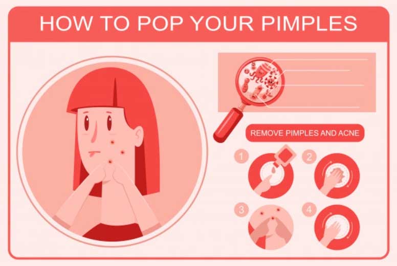Screenshot 2020 12 30 082230 How To Pop A Pimple In a Simple Way?