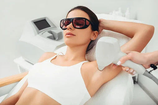 laser hair removal