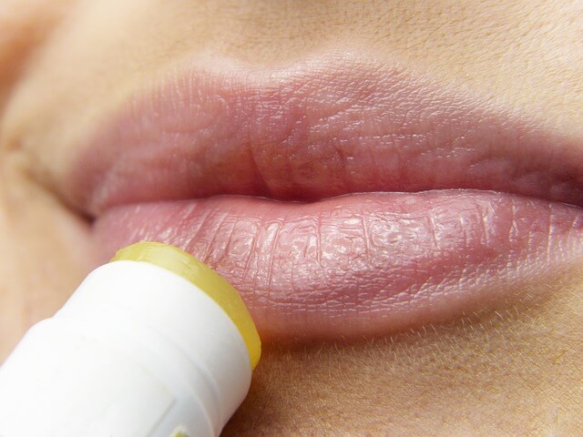 how to get rid of chapped lips