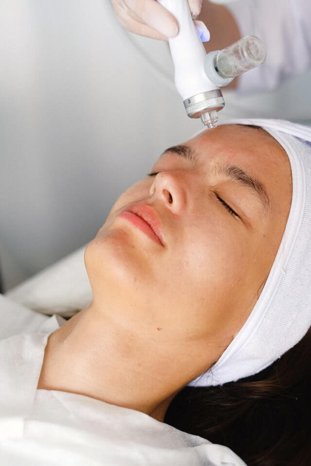 laser treatment for sun damage